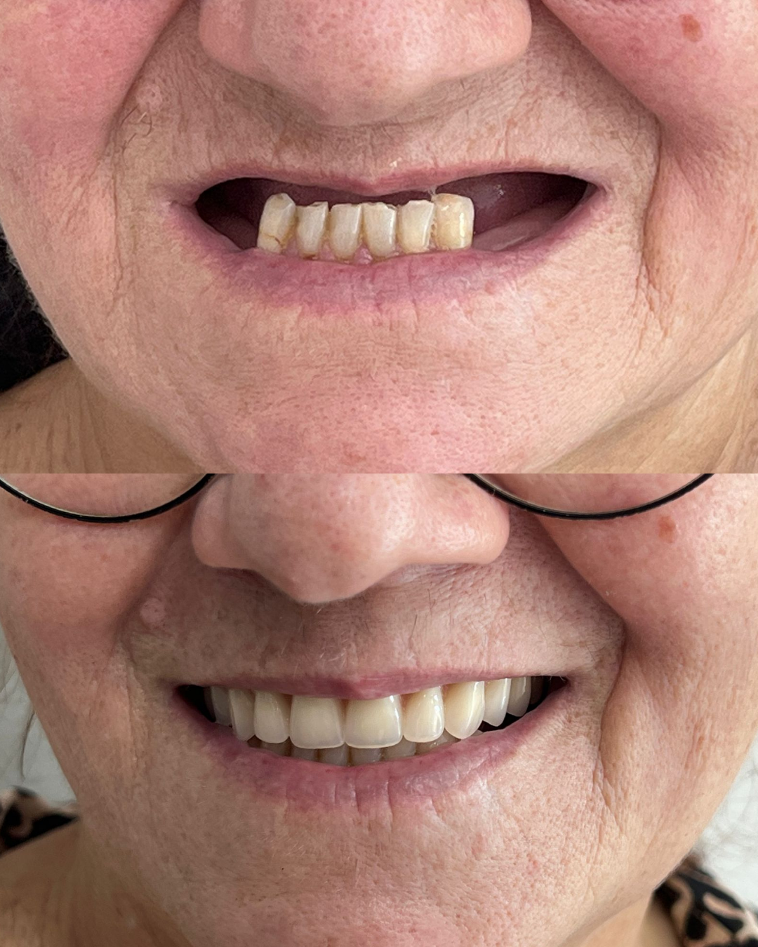 Resultado de Protocolo Fixo Curitiba