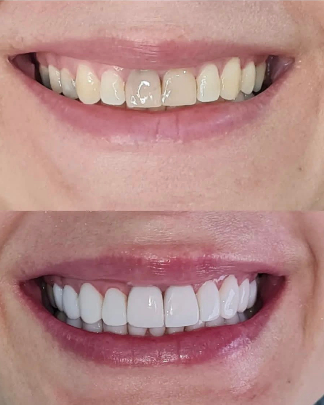 Clínica Elodonto Implantes